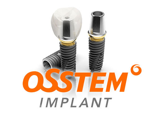 Импланты Osstem - выгодная цена установки под ключ в СПб
